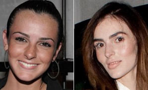 What happened to Ali Lohan's face? Fresh Cheeks
